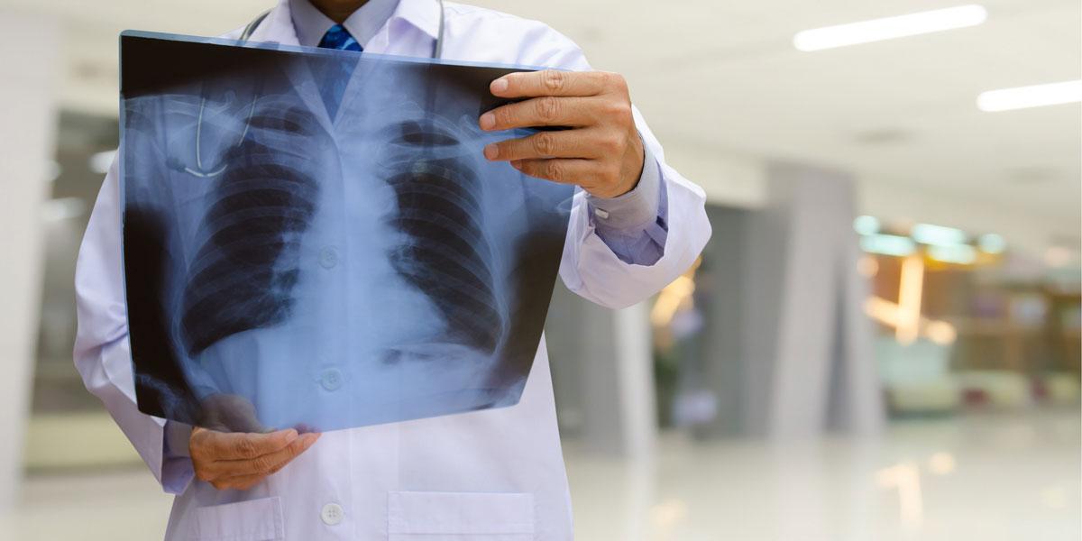 Health professional examining an x-ray.